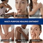 Dermatologist approved intensive therapy balm for eczema prone skin showcasing its thick texture.