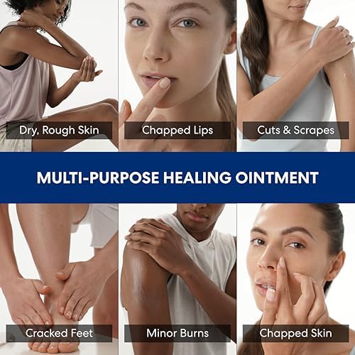 Dermatologist approved intensive therapy balm for eczema prone skin showcasing its thick texture.
