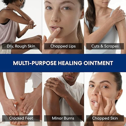Dermatologist approved intensive therapy balm for eczema prone skin showcasing its thick texture.