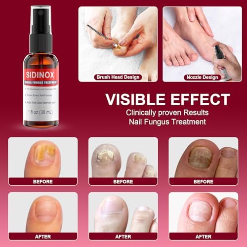 Close up of Sidinox maximum strength fungal nail treatment packaging