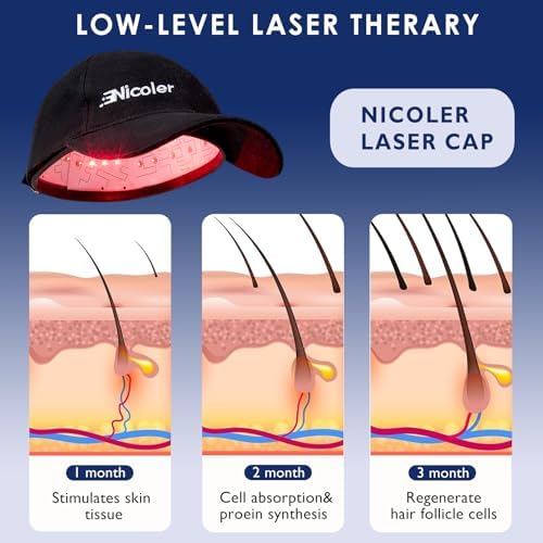 Nicoler hair growth device worn on head
