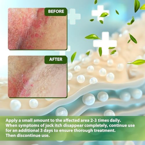 Recuren Plus miconazole nitrate 2 percent cream texture and compact travel tube display.