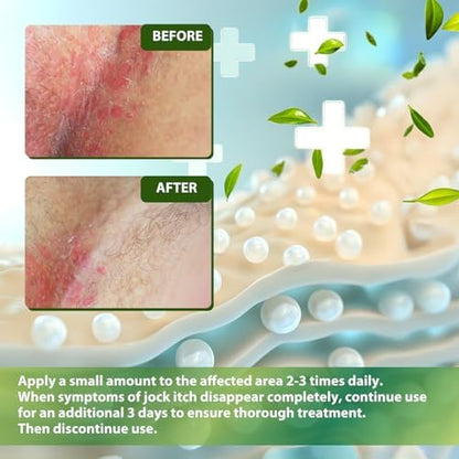 Recuren Plus miconazole nitrate 2 percent cream texture and compact travel tube display.