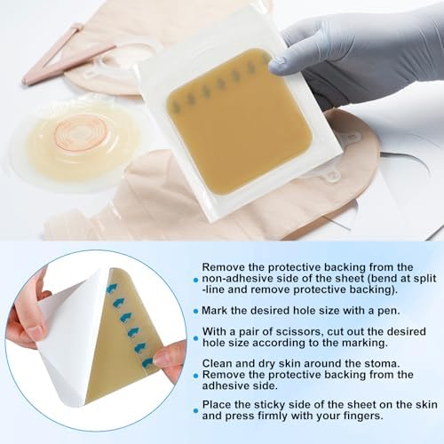 Sterile individually packaged ostomy barrier strips for reliable skin irritation defense