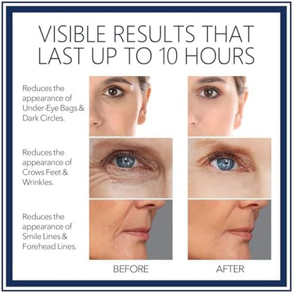 Fzbyylsrg eye serum tube with cap removed