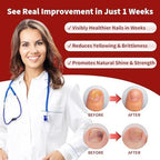 Topical antifungal repair liquid by GemÃ¤chlich ZuHause for treating thick and discolored toenails.