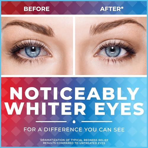 Sterile lubricating eye drops for 12 hour soothing comfort.