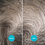Close up of NitWits packaging highlighting the pesticide free and kills super lice claims.