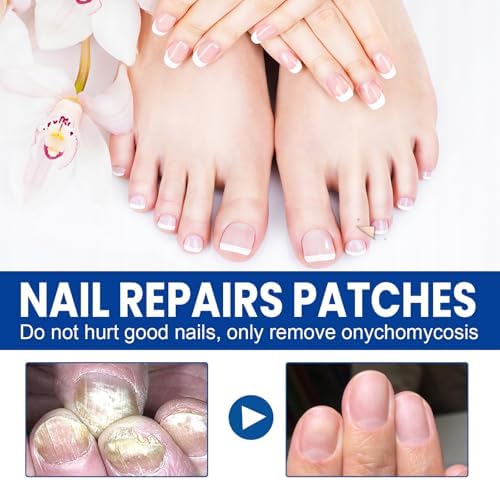 Breathable antifungal nail patches for damaged and brittle nails.