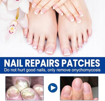 Breathable antifungal nail patches for damaged and brittle nails.