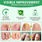 Benefits of Xinszlin ginger nail oil for damaged nails