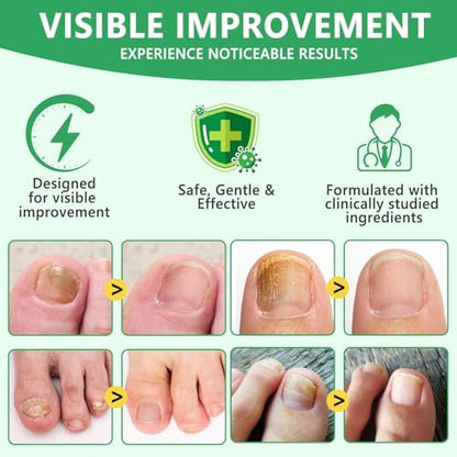 Benefits of Xinszlin ginger nail oil for damaged nails