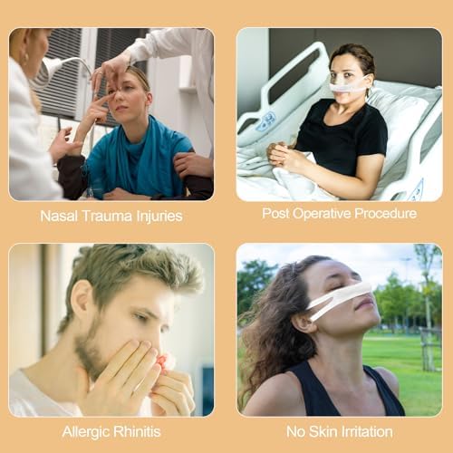 Havinaid medical grade nasal slings for managing swelling and exudate after facial surgery.