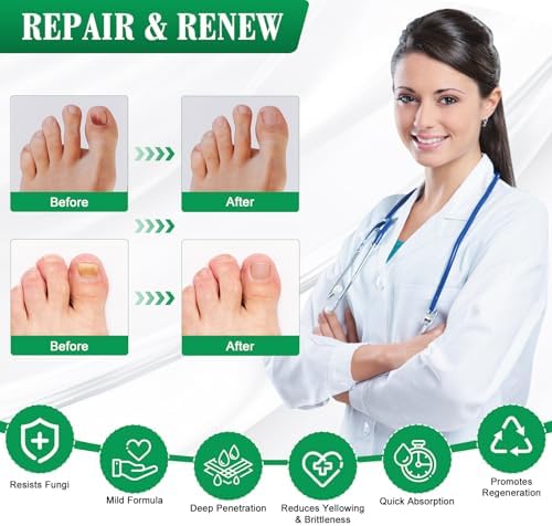 Dermfree antifungal pen being applied to a damaged toenail for fungus removal.