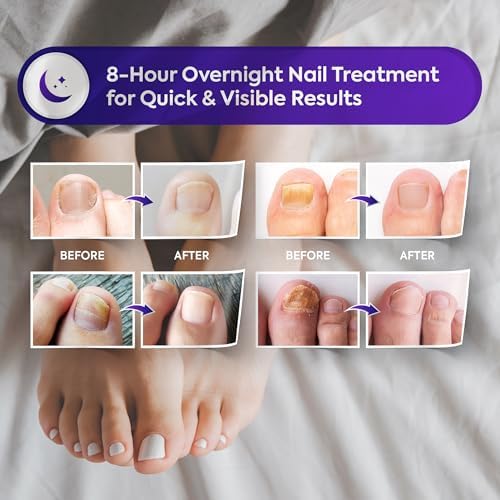The 32 count pack of Natural Vine fungal patches demonstrating the hydrogel moisture formula.