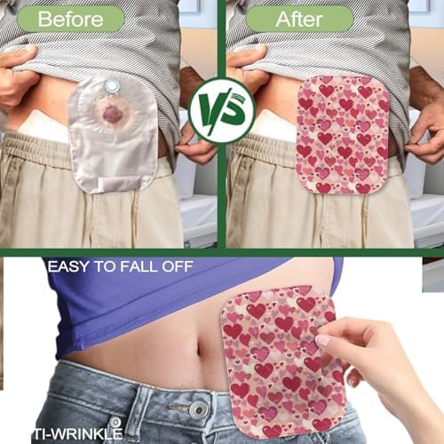 Close up of the durable fabric and opening of a standard sized ostomy cover.