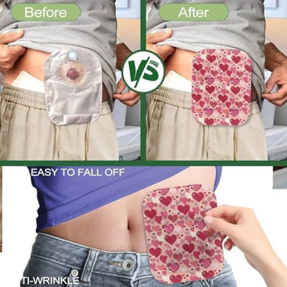 Close up of the durable fabric and opening of a standard sized ostomy cover.