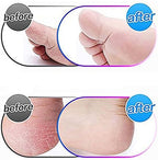 Washable replacement heads for Amope Pedi Perfect compatible with hard skin removal