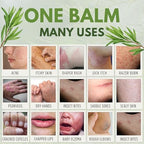 Chamuel premium imported tea tree oil skin balm for athlete foot treatment.