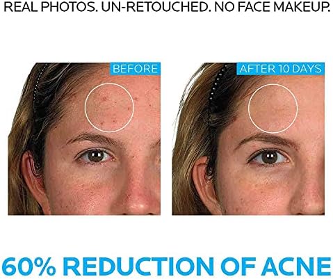 La Roche-Posay pore refining toner for acne-prone and blemish skin