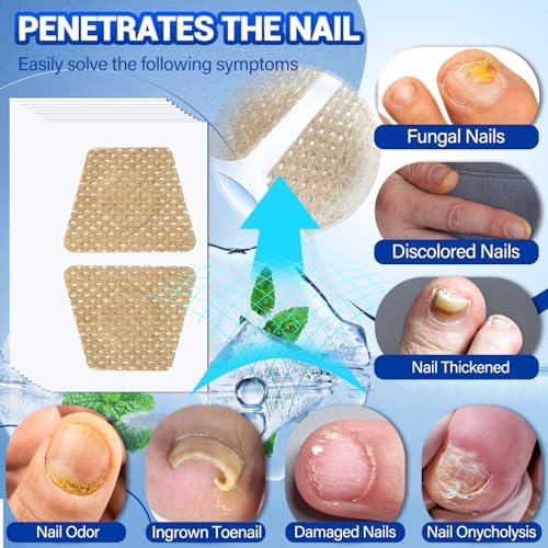 OMO extra strength nail corrector patches with hydrogel technology for fungus treatment.