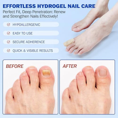 Individually wrapped HUBTURE overnight hydrogel patches for hygienic foot care