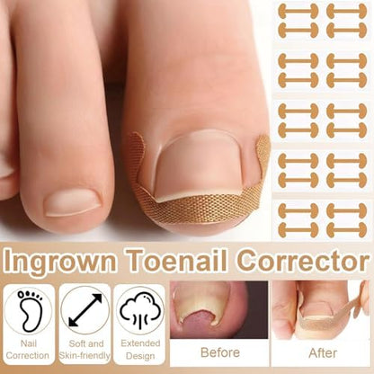 Full layout of the sixteen piece home pedicure set highlighting the multiple styles of corrective alignment stickers