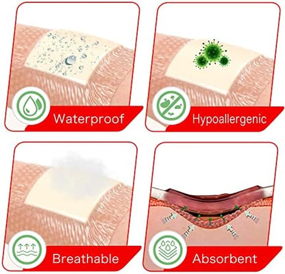 FRESINIDER silicone pressure pads illustrating the absorbent cushioning for bed sore management