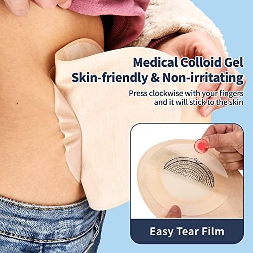 Cut to fit colostomy bags pack of 20 displaying the clear measuring scale from 20mm to 70mm