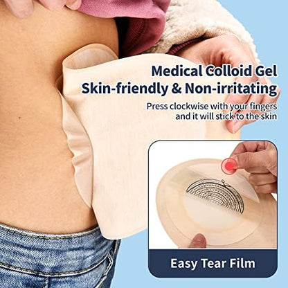 Cut to fit colostomy bags pack of 20 displaying the clear measuring scale from 20mm to 70mm
