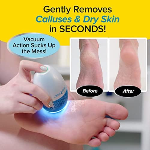 PediVac foot file with built-in vacuum sucking up skin shavings.