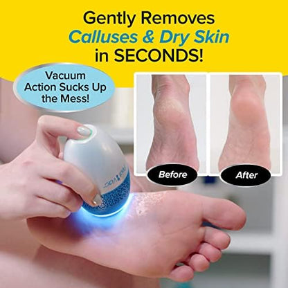 PediVac foot file with built-in vacuum sucking up skin shavings.