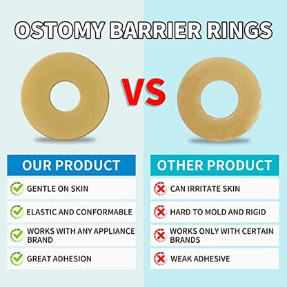 Moldable ostomy ring being shaped to fit personal stoma contours securely