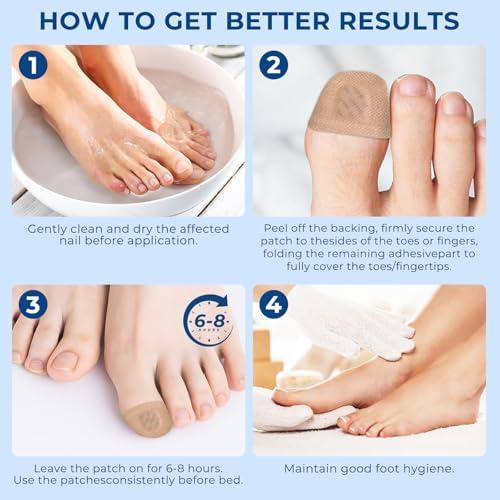 Demonstration of Kitmous patch applied to a toenail for fungal infection care