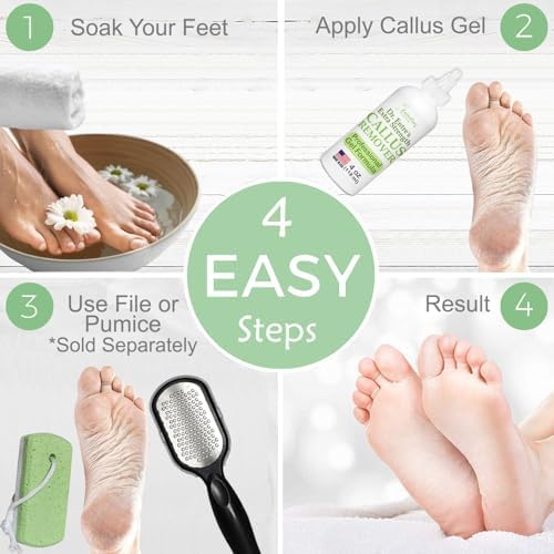 Before and after results using EntreFeet extra strength dead skin remover.