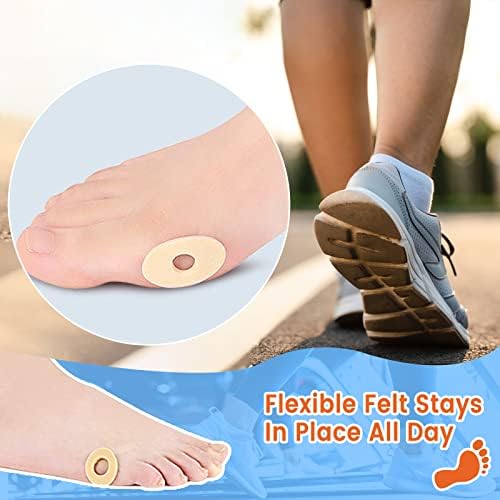White foam U-shaped and oval foot pads for pressure distribution