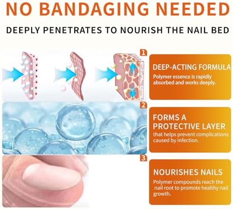 Aimery antifungal nail drops for treating ingrown and thickened toenails.