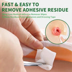 Individually wrapped sting free adhesive remover wipes for ostomy