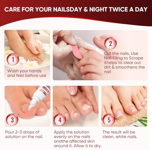 Before and after comparison of clear versus brittle damaged nails using DERMFREE.