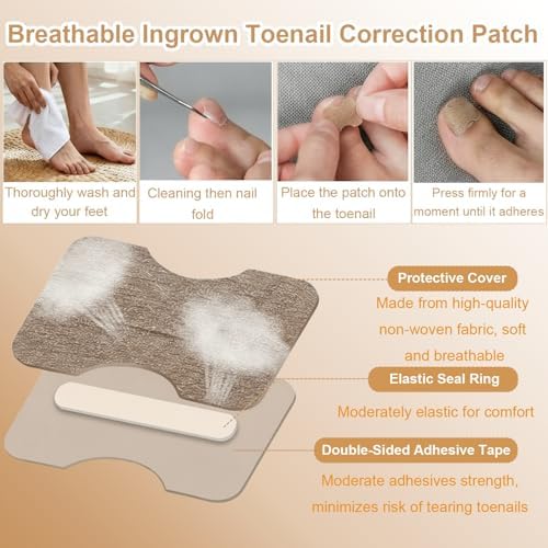 An angled view of the premium nail clippers and gap pens included in the professional toenail removal kit
