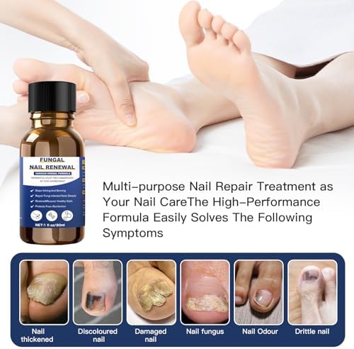 Step by step application of Sechkiss nail repair liquid on infected toenail.