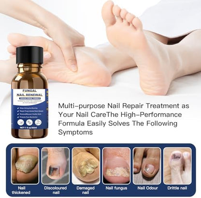 Step by step application of Sechkiss nail repair liquid on infected toenail.