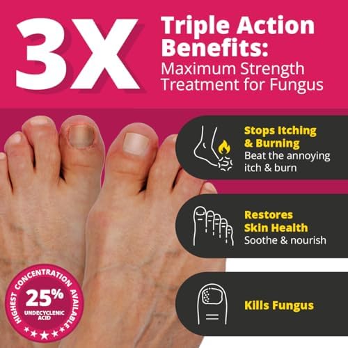 Maximum strength 25 percent undecylenic acid nail fungus treatment packaging details.