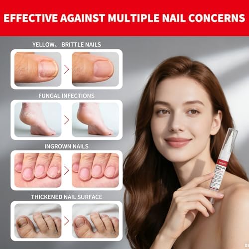 Hand holding the GemÃ¤chlich ZuHause repair pen demonstrating easy application on toenails.
