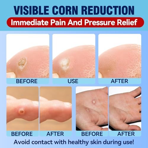 Waterproof adhesive corn remover patch close up showing the soft foam cushion