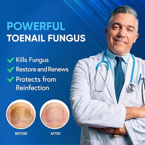 Antifungal nail solution with 25 percent Undecylenic Acid for thick nails