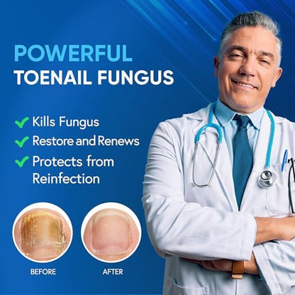 Antifungal nail solution with 25 percent Undecylenic Acid for thick nails