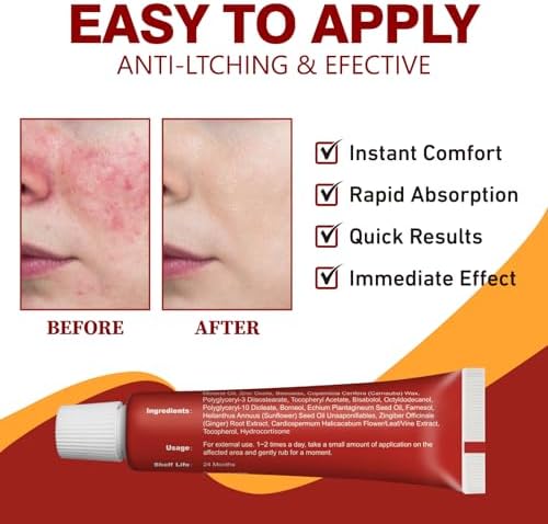 Maximum strength hydrocortisone topical treatment for swelling and redness