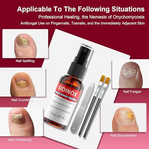 Sidinox 25 percent Undecylenic Acid antifungal liquid bottles for discolored nails