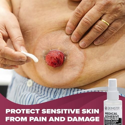 Medical grade prosthetic adhesive remover for sensitive skin